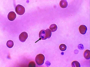 Babesia canis